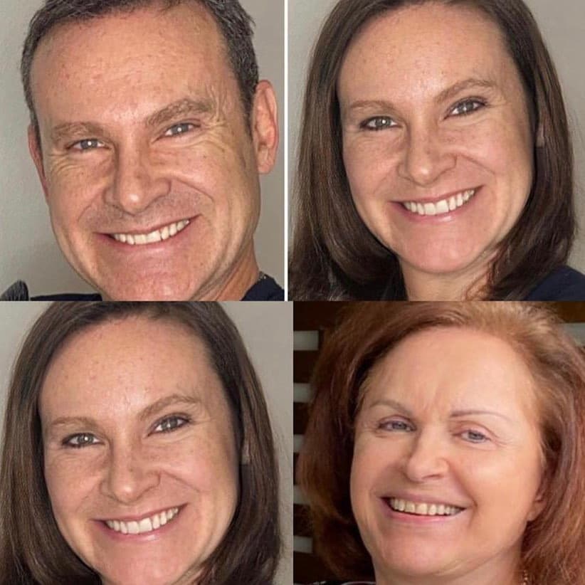 "Así las cosas, yo con el nuevo Face App que esta causando sensación y después le incluí una foto de mi mamá, ¿será que me parezco a ella?", señaló Alan Tacher en su Instagram, tras el impresionante resultado.