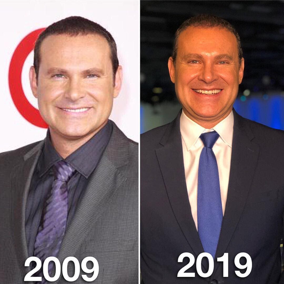 "Yo a todo lo que se pueda al igual que Raúl, soy su conejillo de indias, que transplante, que las ceja. Me he hecho de todo", explicó entre risas el conductor mexicano.