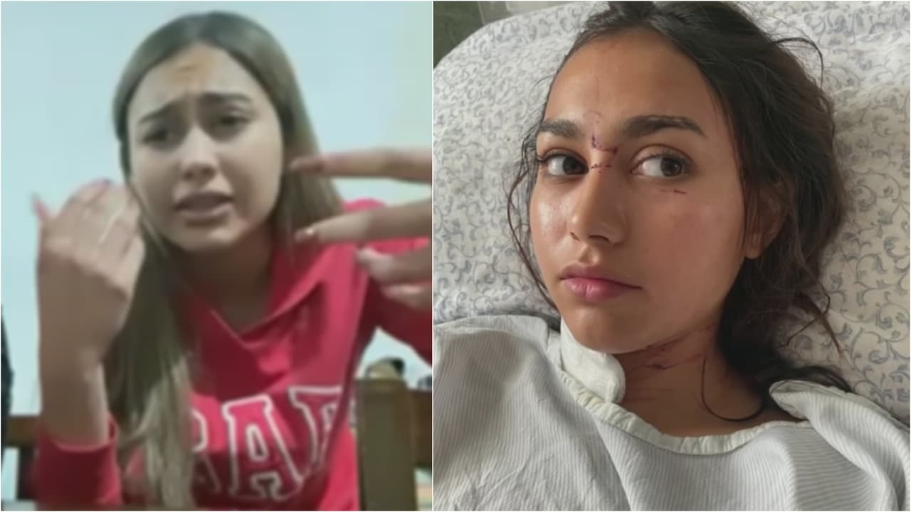 <b>Joven de 17 años sobrevive a un brutal ataque de su expareja: fue apuñalada 47 veces</b>
<br>
<br>Una persona encontró a la joven el suelo y la llevó al hospital donde le atendieron las heridas. Los cargos para el menor que la atacó fueron por lesiones y violencia familiar, pero no por intento de feminicidio, a pesar de las heridas que por poco le cuestan la vida a la joven de 17 años.