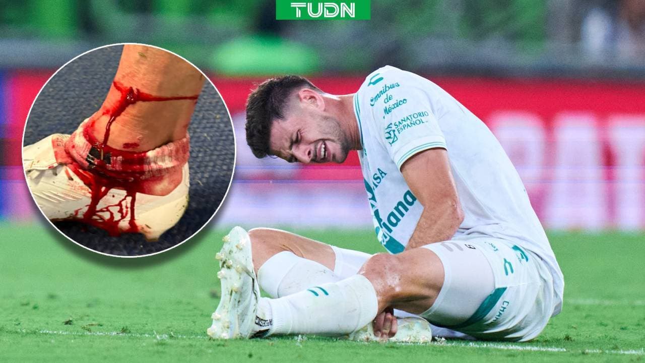 Lucas Di Yorio se pierde gran parte del Apertura 2026