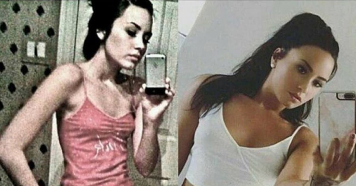 En octubre de 2017, con esta imagen, Demi Lovato hizo eco de su desorden alimenticio y sus problemas con las drogas. Sin tapujos, la joven revelaba en un documental el viacrucis que había sufrido desde los nueve años.
<br>