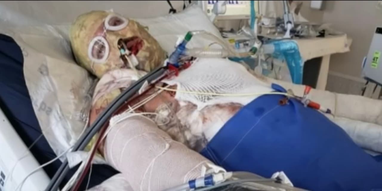 Con toda urgencia, Alexis fue llevado a un hospital en esa ciudad mexicana donde los médicos no le dieron muchas esperanzas de vida tras examinar sus heridas. Por esa razón, al ser ciudadano estadounidense, 
<b>fue trasladado al US Army Institute of Surgical Research en San Antonio, Texas. </b>
<br>