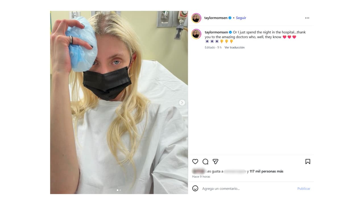 Así se dejó ver tras la picadura de una araña en México.