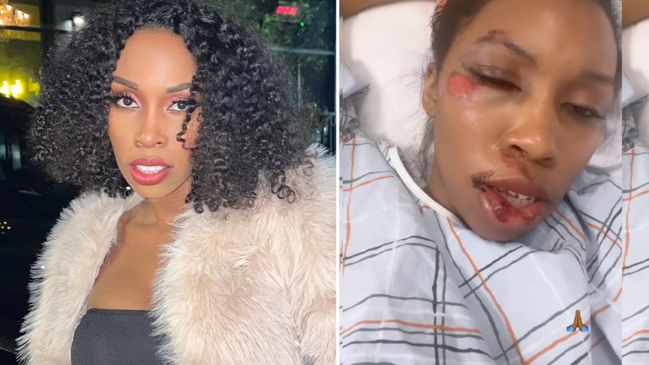 Carrie Bernans, actriz de Marvel, fue atropellada mientras comía y ahora no puede caminar