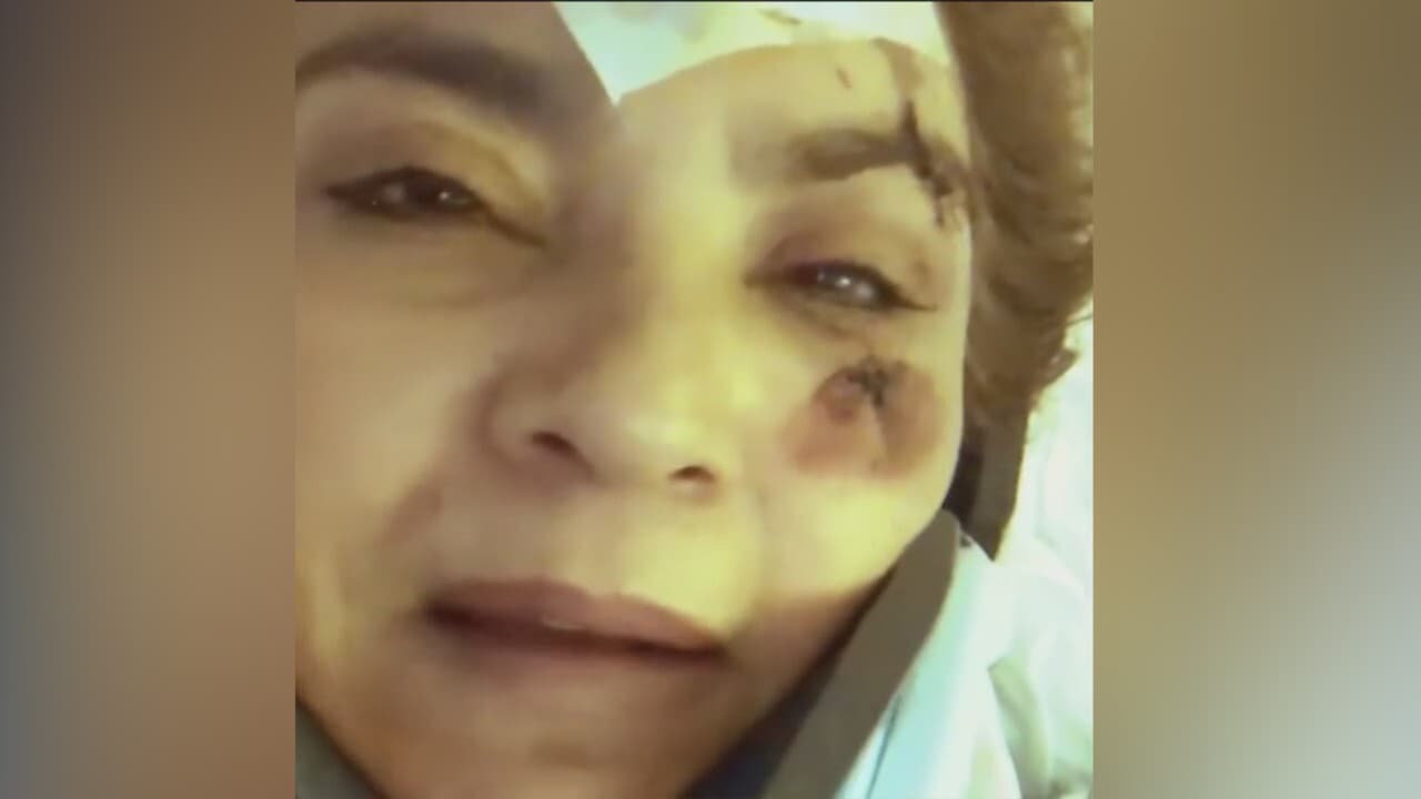 <b>"Me golpeó contra una columna de metal": hispana que sufrió ataque en el metro de Nueva York</b>
<br>
<br>Ruth León-Villegas, de 55 años, contó que un indigente la golpeó cuando estaba esperando el tren y que por fortuna no la arrojó a los rieles.