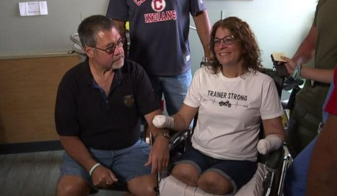 La historia de la mujer que despertó de un coma y descubrió que le amputaron sus piernas y manos por una infección por la saliva de su perro