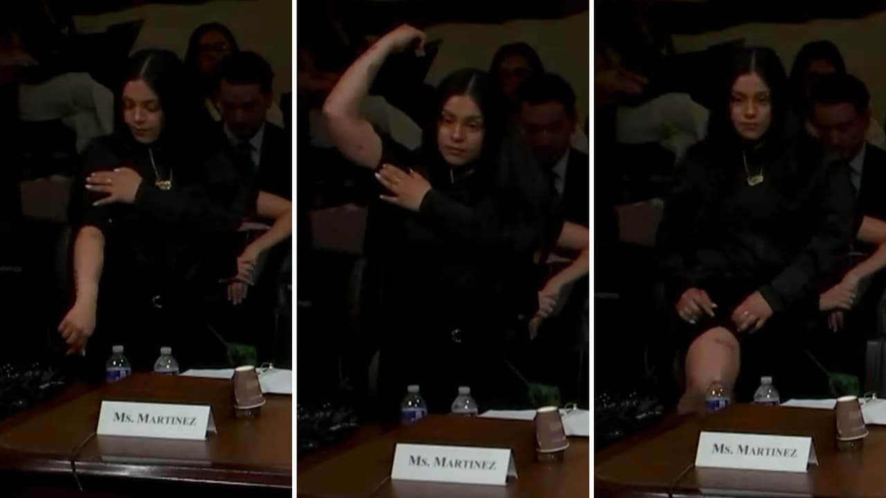 Marimar Martínez expone ante el Congreso las heridas que le dejó un agente fronterizo