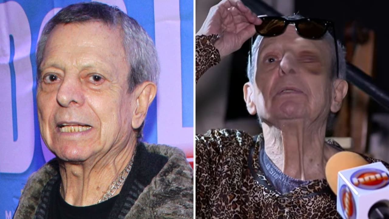 César Bono, actor de ‘Vecinos’, espera no perder la visión del ojo donde tenía tumor: esto le pasó