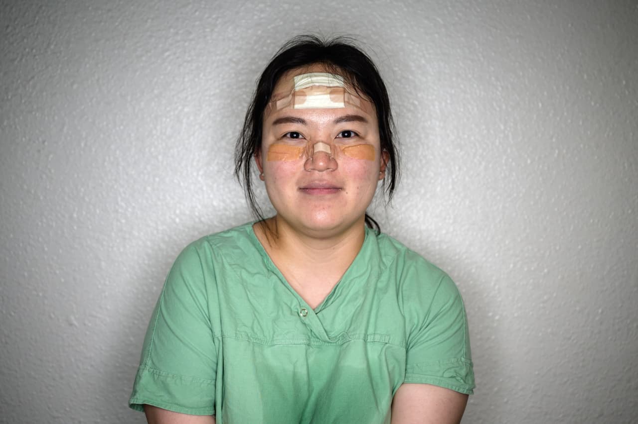 Con almohadillas y cinta adhesiva las enfermeras protegen sus rostros de las llagas dolorosas que pueden desarrollarse por las máscaras protectoras que utilizan por muchas horas.
<a href="https://www.univision.com/noticias/salud/desde-aislamientos-masivos-hasta-control-telefonico-esto-es-lo-que-estan-haciendo-los-paises-para-controlar-el-coronavirus">Vea aquí lo que están haciendo los países para combatir el coronavirus </a>