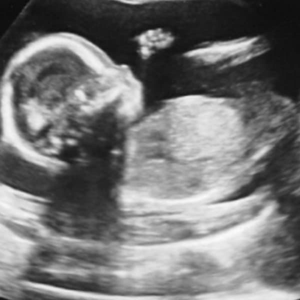 Ella subió este ultrasonido comentando que estaba embarazada, ¡y tendría una hija!