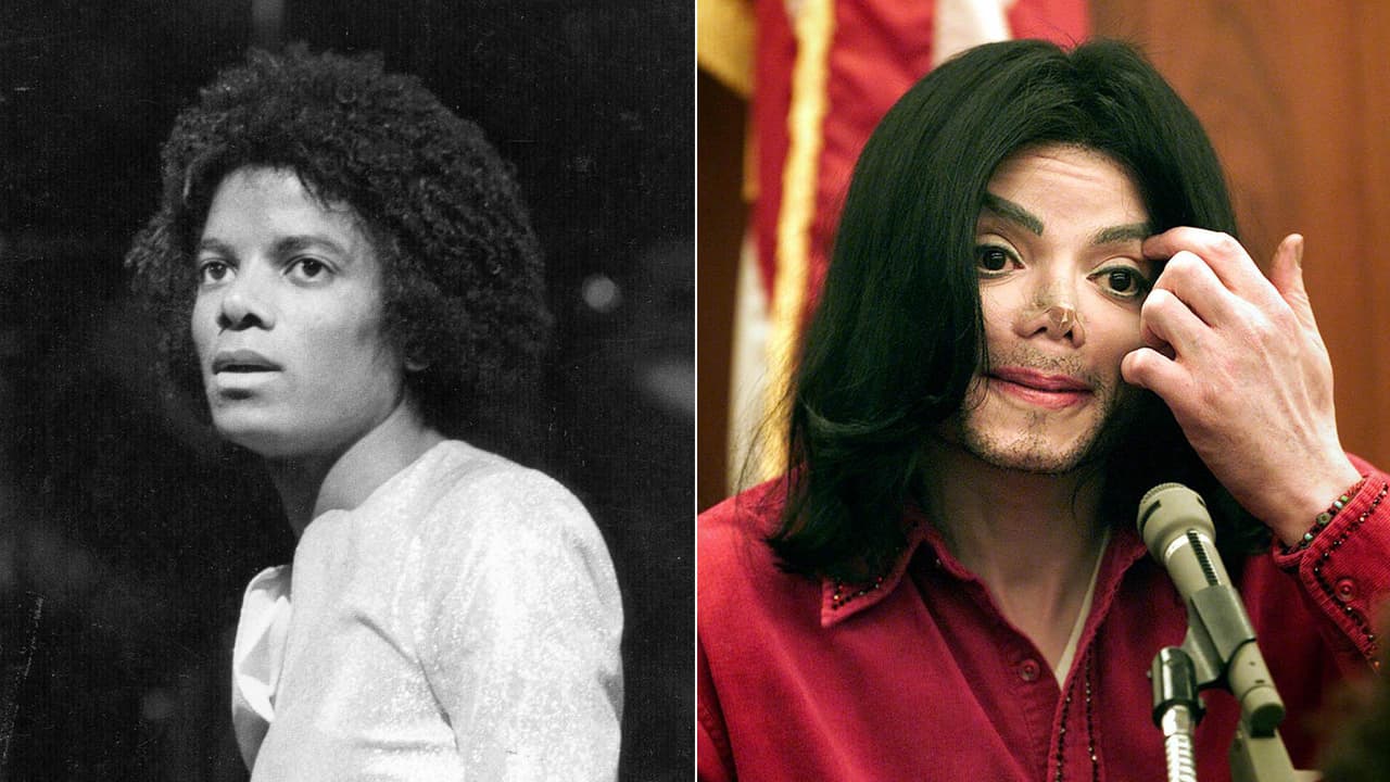 <b>Michael Jackson</b>: es tal vez el ejemplo más fuerte de esta categoría. El rey del pop, primero, se sometió en múltiples operaciones de nariz, pero también se cambió el color de piel, algo que finalmente deterioró su aspecto físico.
<br>