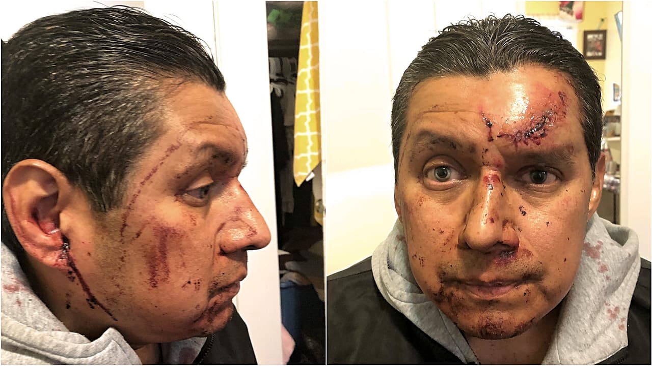 “Estaba a minutos de desangrarse”: atacan brutalmente a inmigrante mexicano que paseaba a su perro frente a su casa