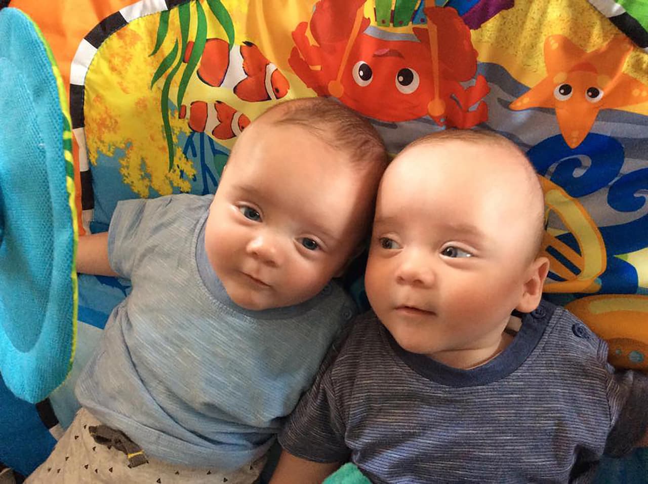 Karen y Kris tenían tres opciones: abortar, no hacer nada o realizar la cirugía.