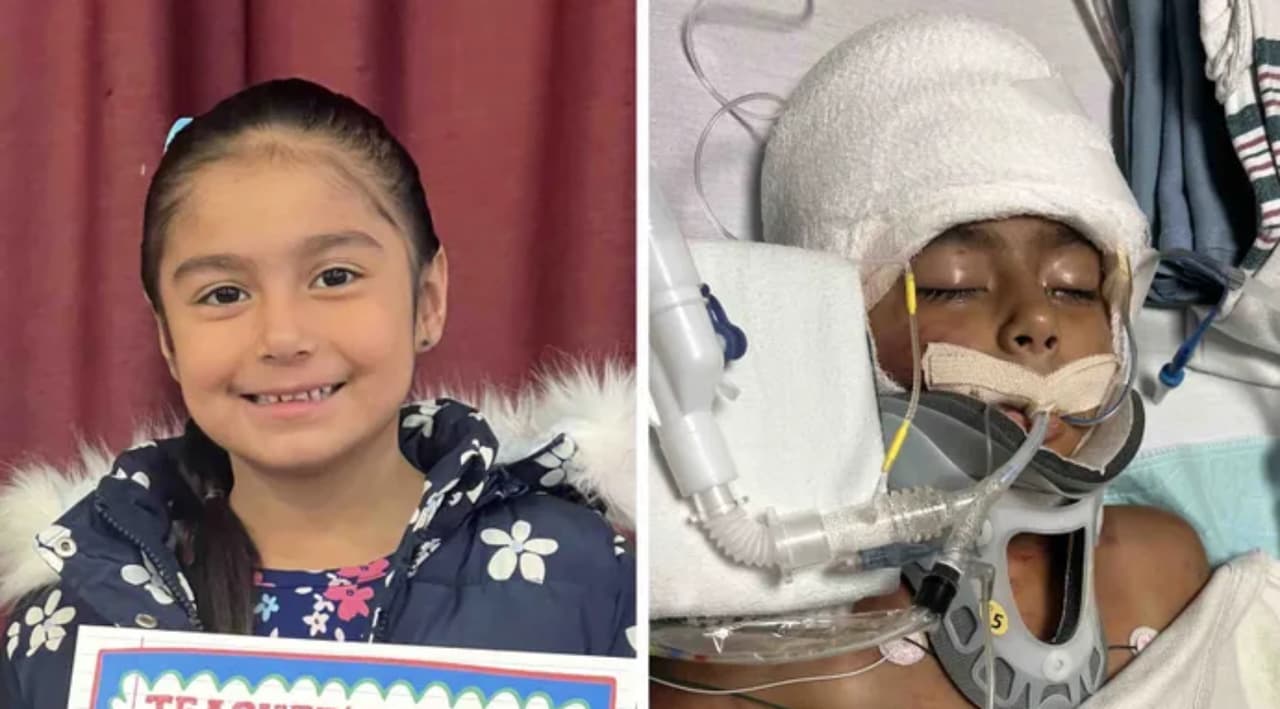 La pequeña Scarlett perdió ambas orejas y tuvo heridas de gravedad por el ataque de los perros.