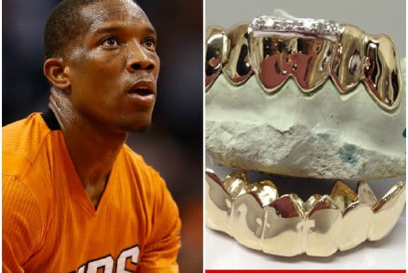 Basquetbolista adorna sus dientes con oro y diamantes