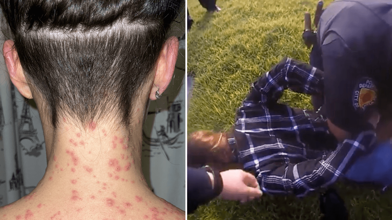 La demanda de una mujer que alega fue picada por hormigas durante arresto de la policía seguirá en pie