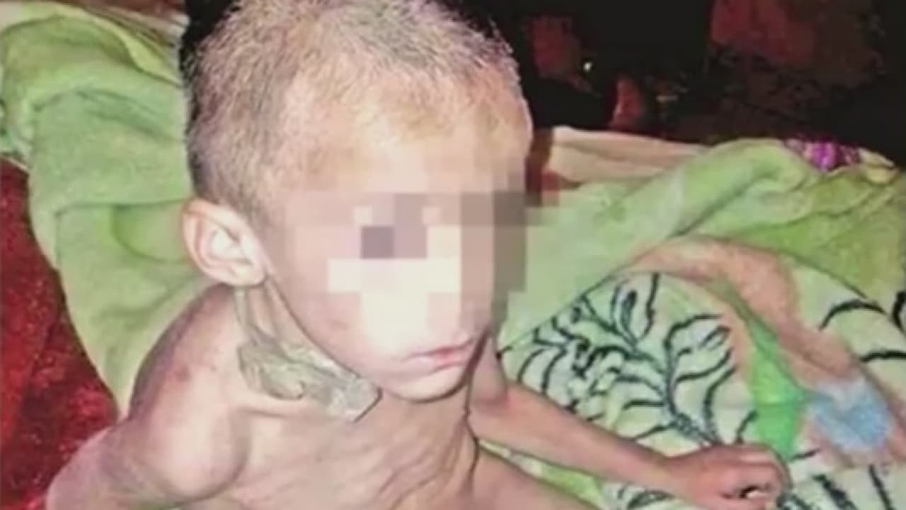 Pancreatitis y heridas en los genitales: así va el caso de Antony, el niño estadounidense maltratado por familiares en México 