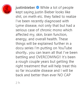 “Mientras muchas personas decían que Justin Bieber se veía como una mierda, en metanfetaminas, etc., no se daban cuenta que me habían diagnosticado recientemente la enfermedad de Lyme”, escribió el intérprete.