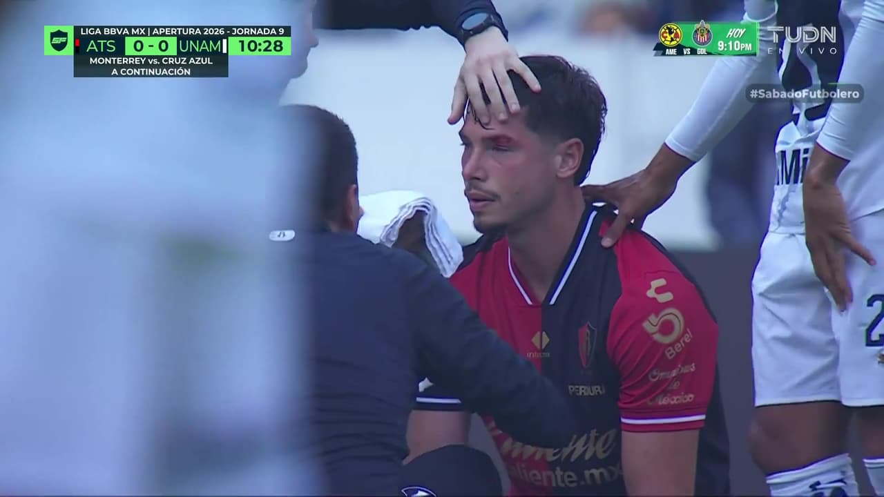 ¡Imágenes sensibles! Capasso debe ser atendido por una herida en el rostro