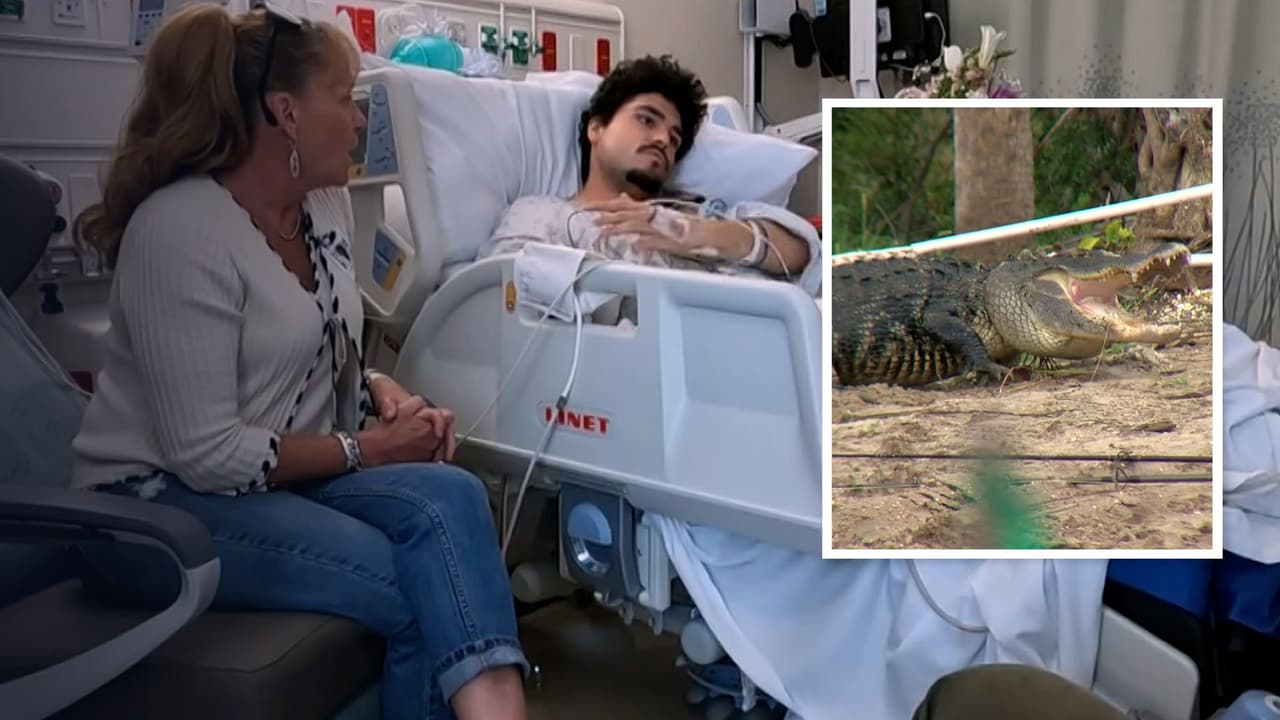 "No perdí la vida, solo un brazo": joven es atacado por caimán en un estanque de Florida y vive para contarlo 