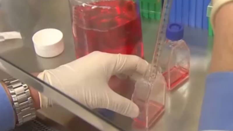 Segundo caso de paperas en Nueva Jersey ocupa la atención de los funcionarios de salud