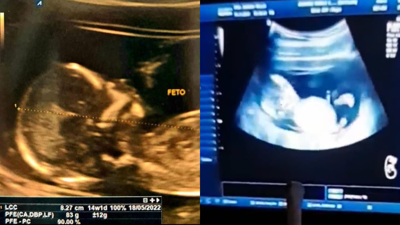 Con estas imágenes, el hijo de Eduardo Yáñez dio a conocer que será papá de nueva cuenta.