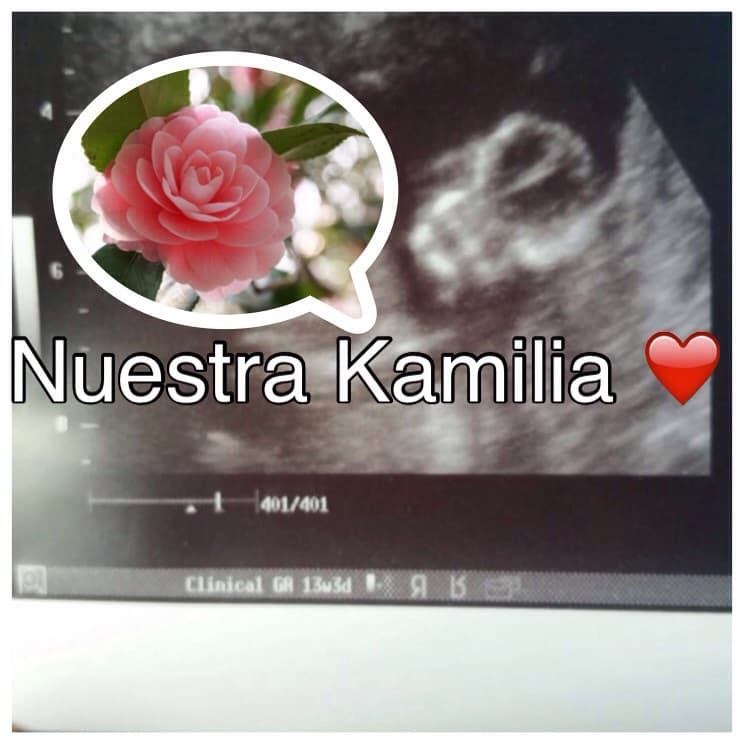 Gredmarie compartió el sonograma 4D de su adorada baby Kamilia