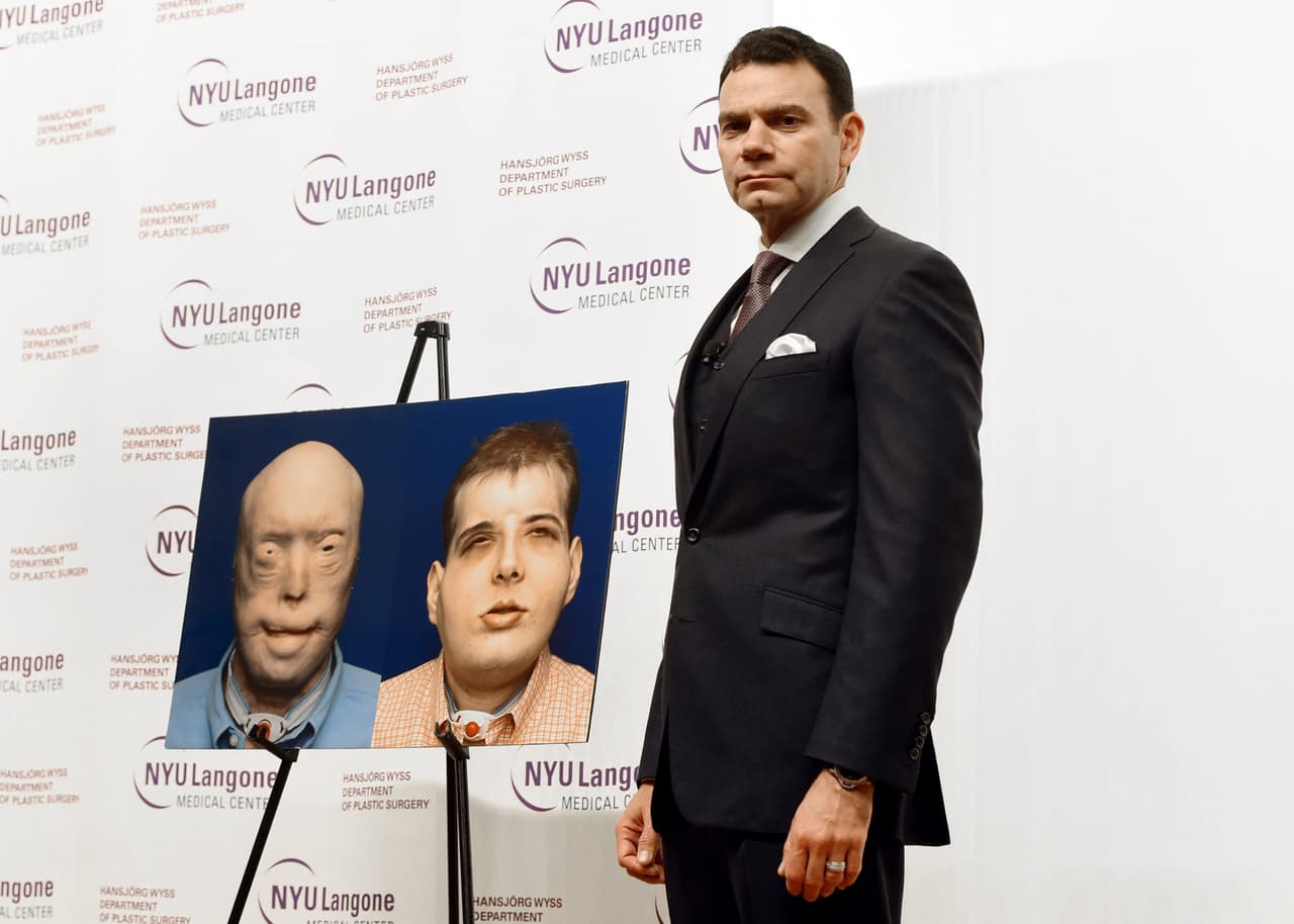 <b>Eduardo Rodríguez. </b>Nació en Miami, es hijo de inmigrantes cubanos, preside el departamento de cirugía plástica y reconstructiva Hansjörg Wyss y 
<b><a href="http://www.univision.com/noticias/salud/estos-profesionales-de-la-salud-creen-que-ser-hispanos-les-hace-mejores-en-su-trabajo">dirige el programa de trasplantes de rostro en el NYU Langone Medical Center. </a></b>En agosto de 2016 conmemoró un año de su exitoso trasplante de rostro que lideró. Su paciente Patrick Harrison, un bombero de Mississippi que había sufrido quemaduras intensas en su cara en 2001, aún se recupera del delicado y pionero procedimiento, que ha sido reconocido como el más exhaustivo realizado hasta la fecha en todo el mundo.