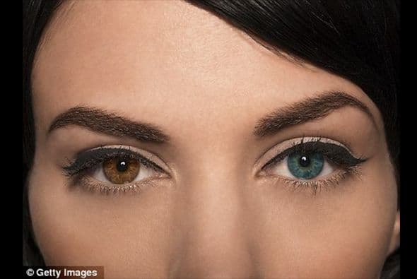 Cambio de color de ojos: Una técnica con láser podrá hacer uno de tus sueños realidad si de cambiar el color de tus ojos se trata.
