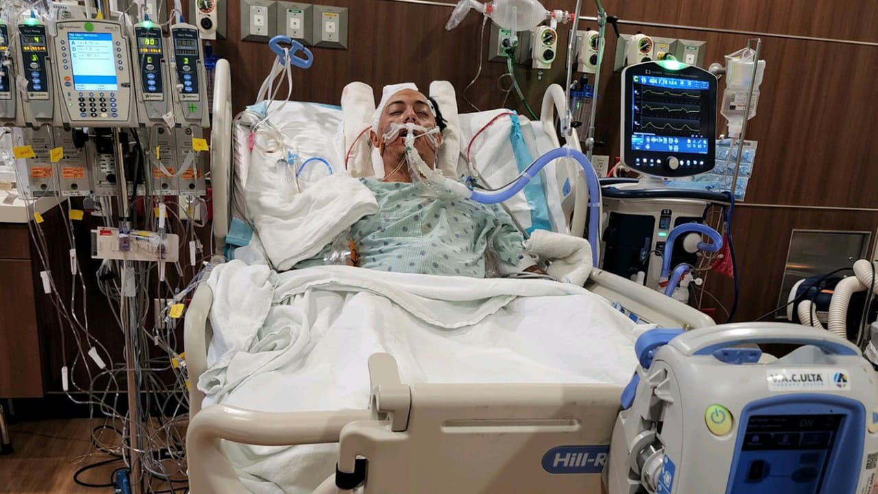 <b><a href="https://www.univision.com/local/houston-kxln/atropellamiento-eduardo-favela-motociclista-video-houston-fotos" target="_blank">Favela</a></b> estuvo internado varios días en la unidad de cuidados intensivos, la familia no perdió la esperanza de que se recuperara, pero días después el joven murió.