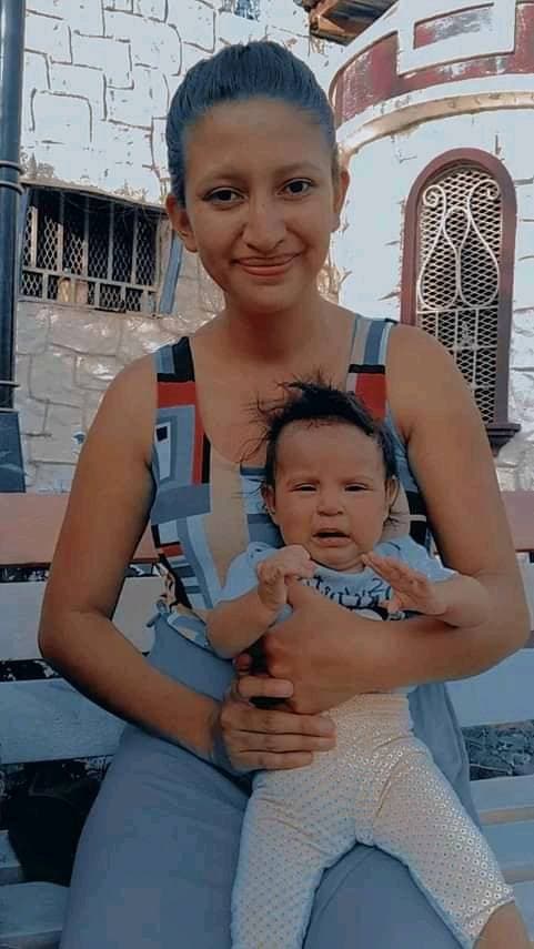 Sofía es una bebé tierna, llena de vida, y quien la ve nunca pensaría que tendría una rara condición congénita. “Cuando yo la tuve mi hija nació morada y ahí me di cuenta de que ella traía lo mismo que yo, ” dice Kelly D. Díaz Martínez, madre de Sofía.