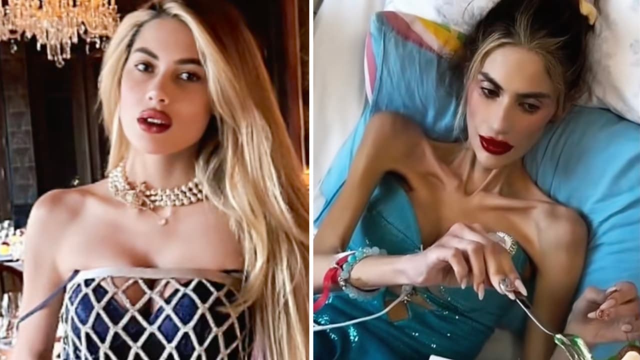 Muere estrella de 'Survivor' tras sufrir trastorno alimenticio: sus últimos videos desde el hospital