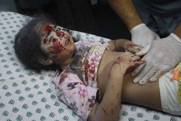 La gente puede llamarnos sin que le cueste nada. Contamos con equipos interdisciplinarios, compuestos de enfermeras, psicólogos, trabajadores sociales y especialistas en rehabilitación. Fuente: ©Deutsche Welle