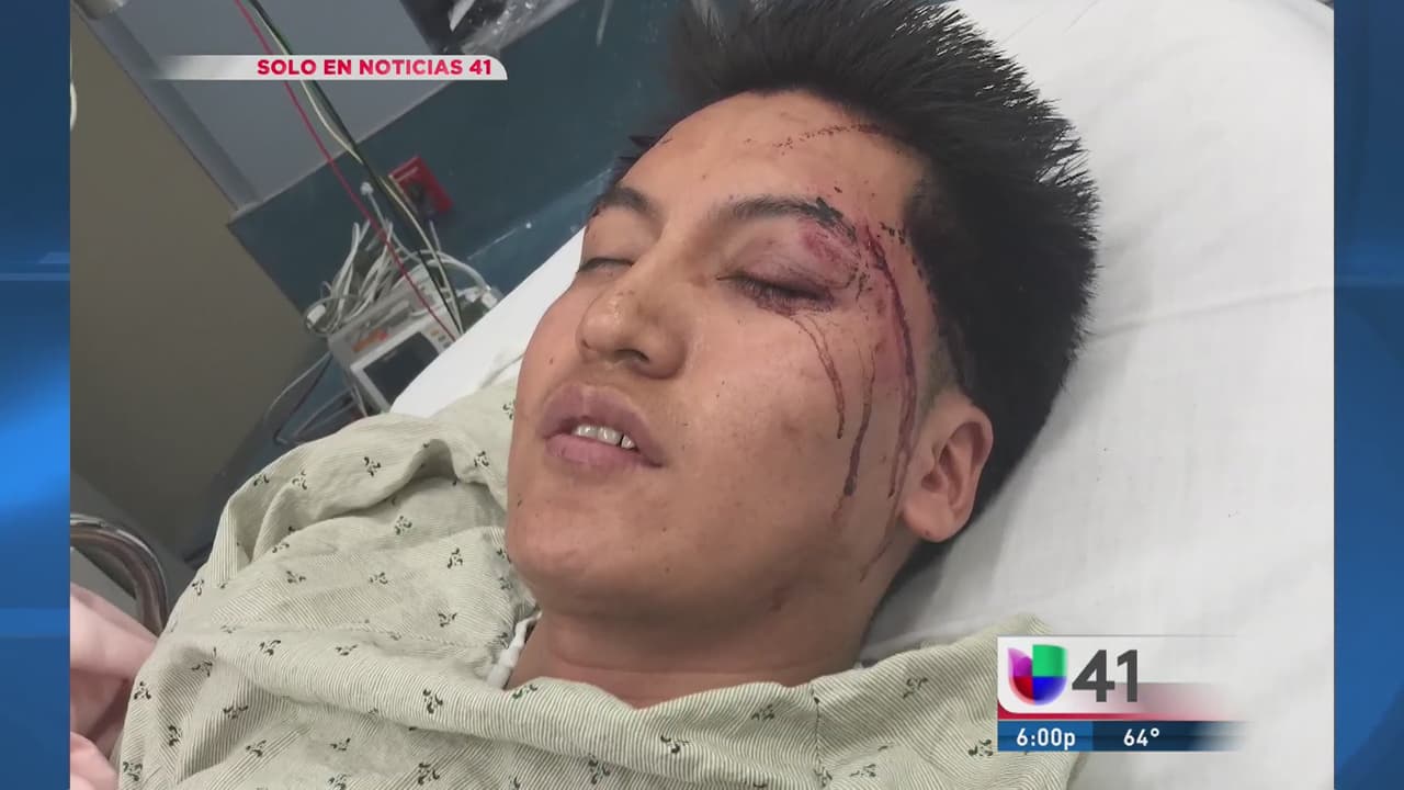 Ecuatoriano queda mal herido tras brutal asalto en New Jersey