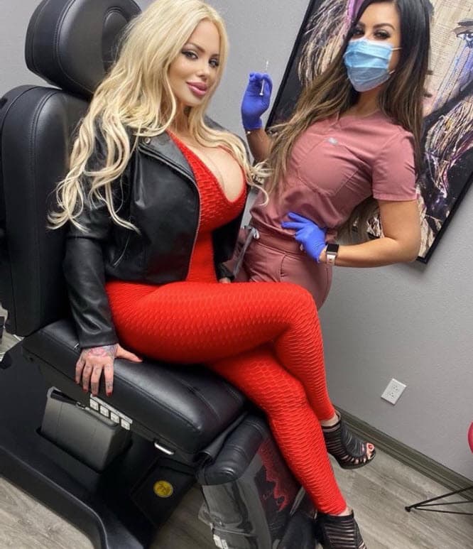 "Me hice aumento de labios, mucho, me hice pómulos, me marcaron la mandíbula, me hicieron ojos de gato que es lo que yo quería, usaron mucho relleno y mucho bótox. Como a 
<b><a href="https://www.youtube.com/watch?v=i3aRpFyI-m0&feature=emb_title" target="_blank">mí me gusta en mucha cantidad</a></b>, pues la cara me quedó diferente, me gusta". 
<br>