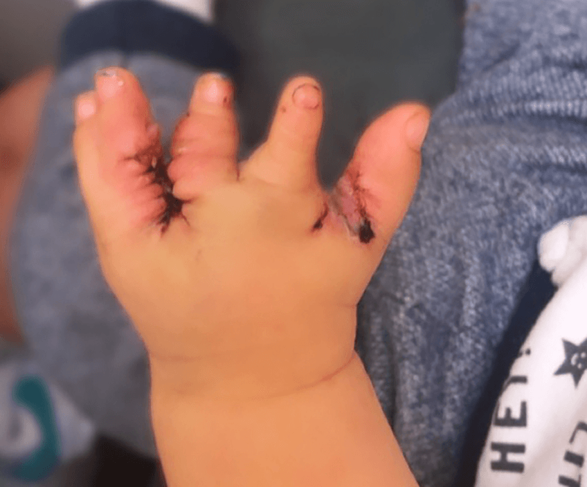 Tobias Lugo tiene 4 años y ha sido intervenido múltiples veces.