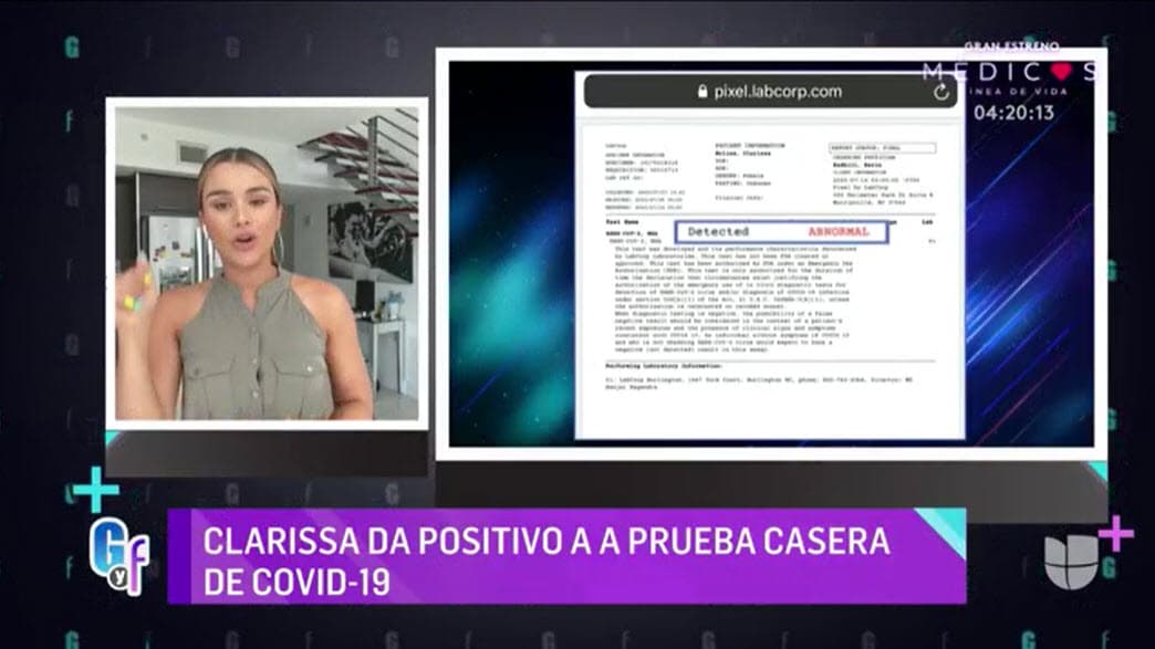 Desde el pasado 14 de julio, la dominicana confirmó que estaba contagiada luego de someterse a una 
<b><a href="https://www.univision.com/shows/el-gordo-y-la-flaca/clarissa-molina-anuncia-que-dio-positivo-a-la-prueba-del-coronavirus-en-el-gordo-y-la-flaca-video" target="_blank">primera prueba</a></b> para detectar el virus que tiene en vilo a todo el mundo. 
<br>