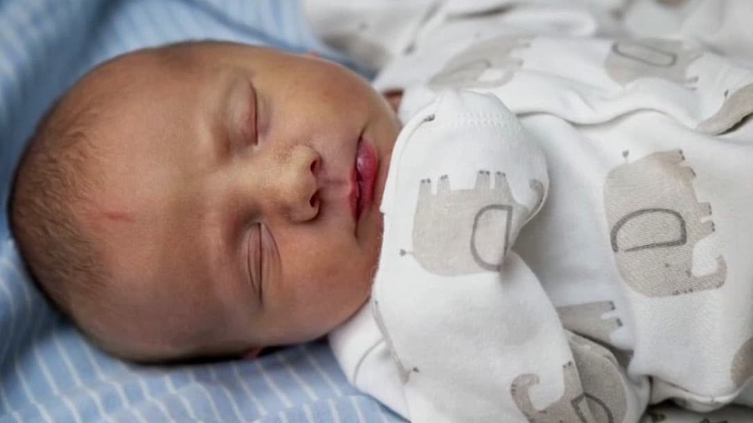 Cirugía fetal experimental logra corregir gastrosquisis en un bebé de 26 semanas de gestación | Entrevista