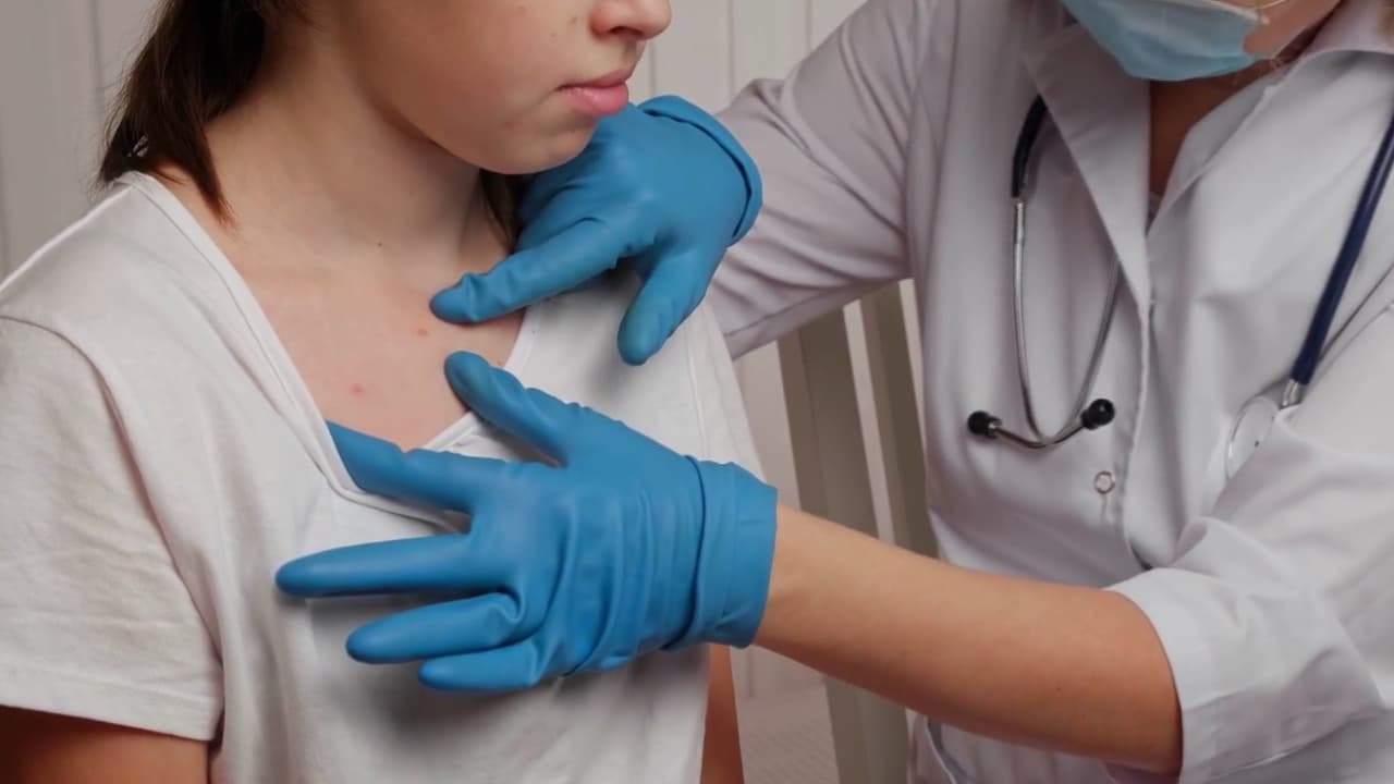 Seis casos de sarampión en Sacramento y Placer; autoridades urgen vacunación infantil