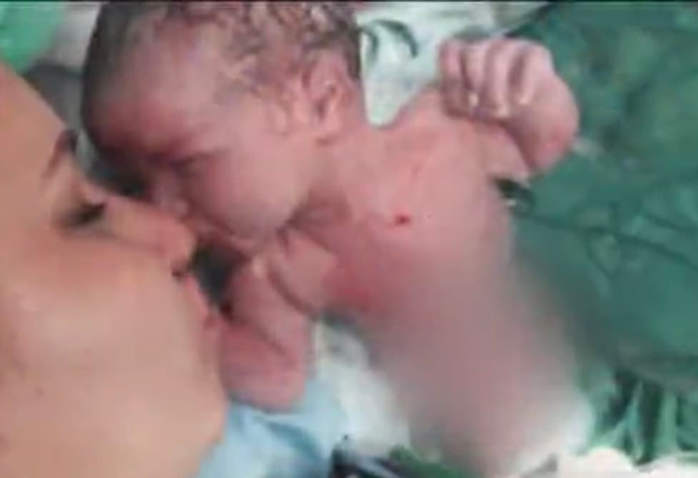 Sin embargo, en medio de la alegría de por fin tener a su bebé en brazos, pronto se dio cuenta que Santiago había nacido 
<b>con una malformación en su pierna derecha</b>, sin imaginar que les sería casi imposible encontrarle una cura.