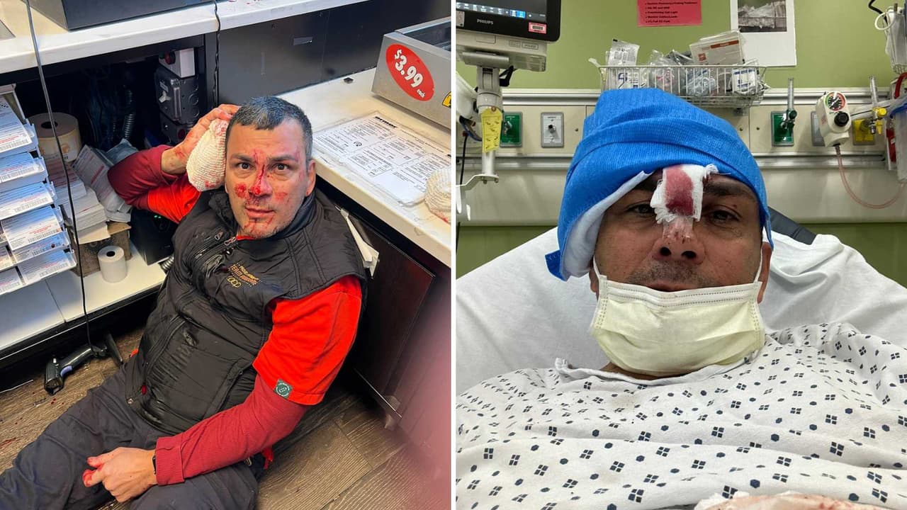 Nicaragüense víctima de brutal golpiza en gasolinera donde trabajaba busca justicia