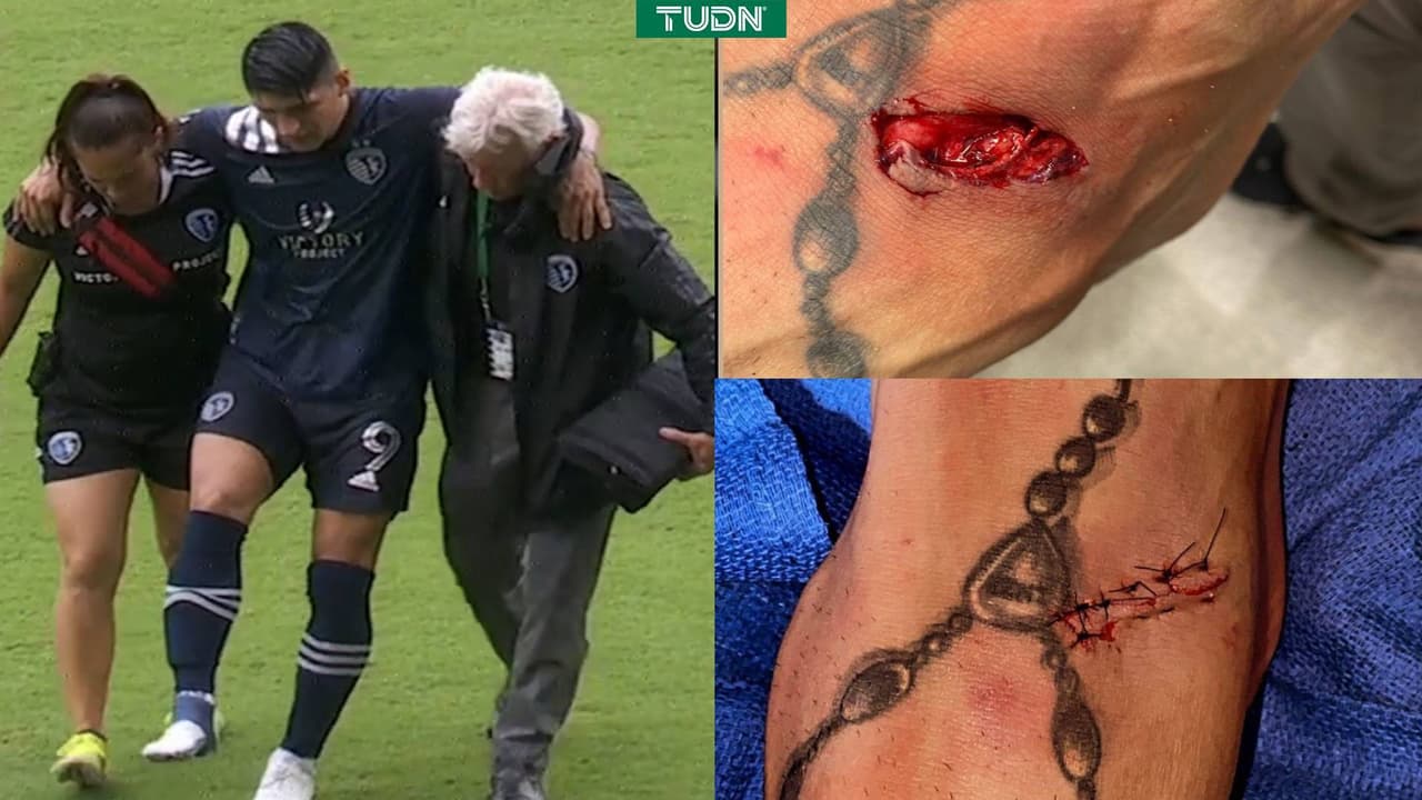 Espeluznante: Alan Pulido mostró la terrible herida que sufrió en la MLS