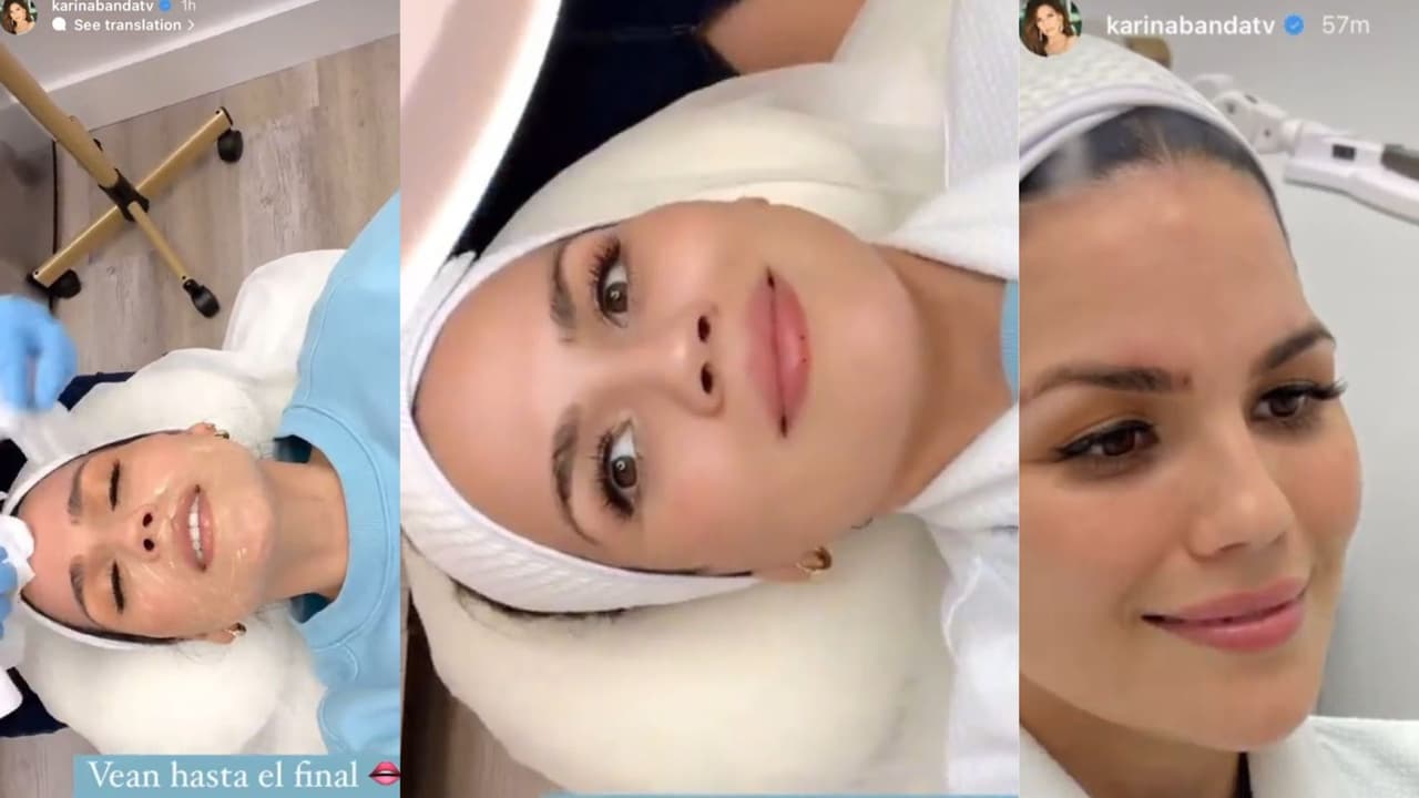 Karina Banda se sometió a procedimientos estéticos.
