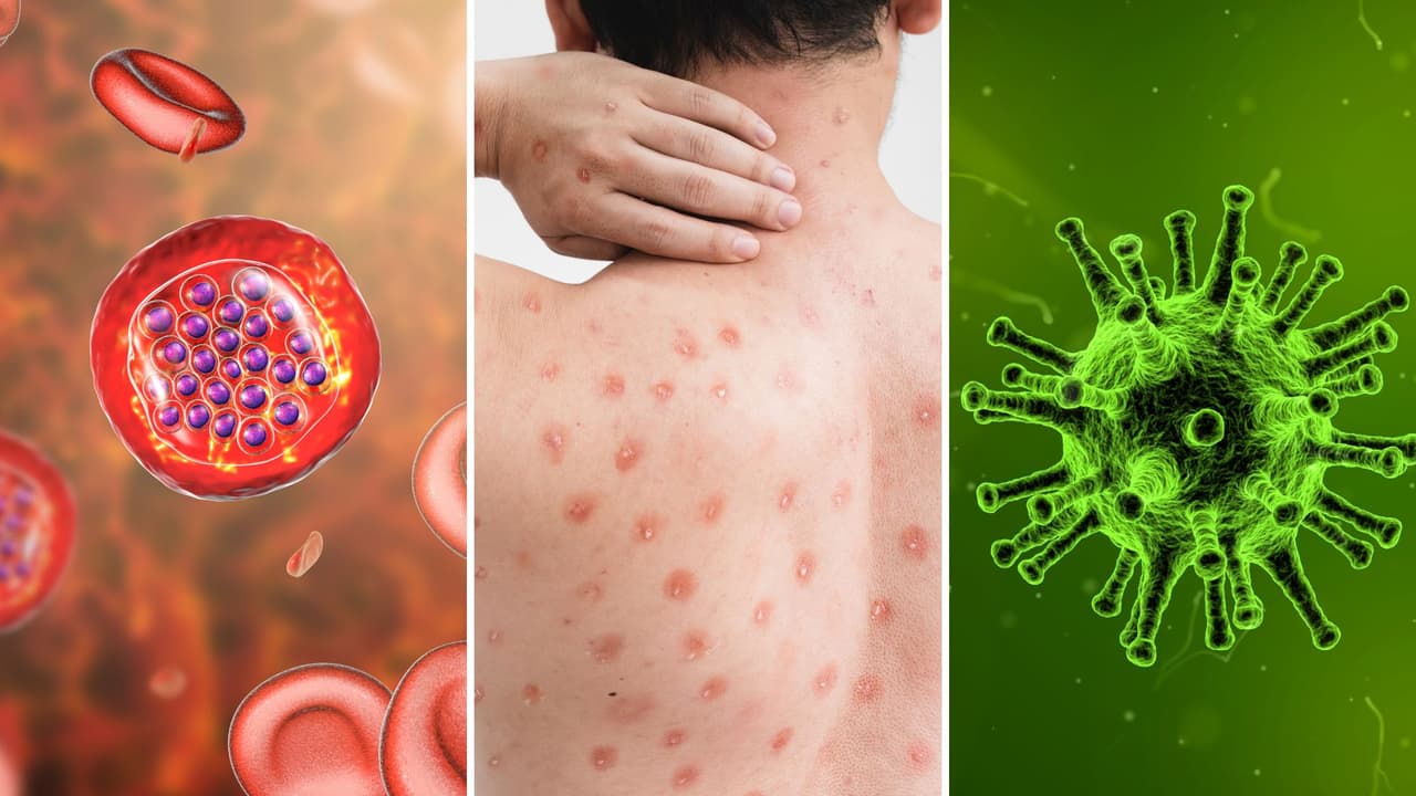 Estas son las 7 enfermedades de las que tienes que cuidarte si vives en Nueva York y Nueva Jersey