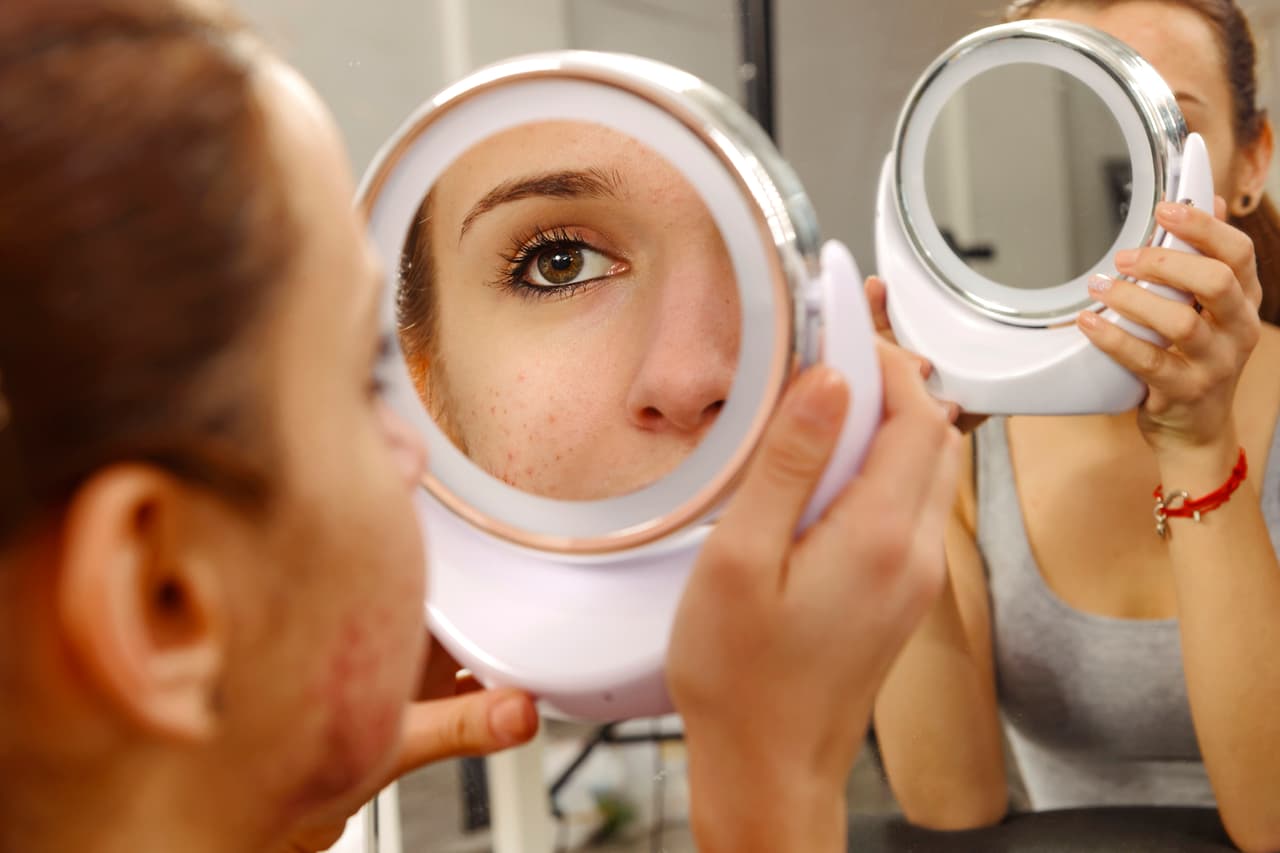 Prevenir es mejor que curar. La piel es un caldo de cultivo para las bacterias y los fluidos sebáceos, por lo que prevenir resulta el mejor antídoto a la hora de eliminar los puntos negros.