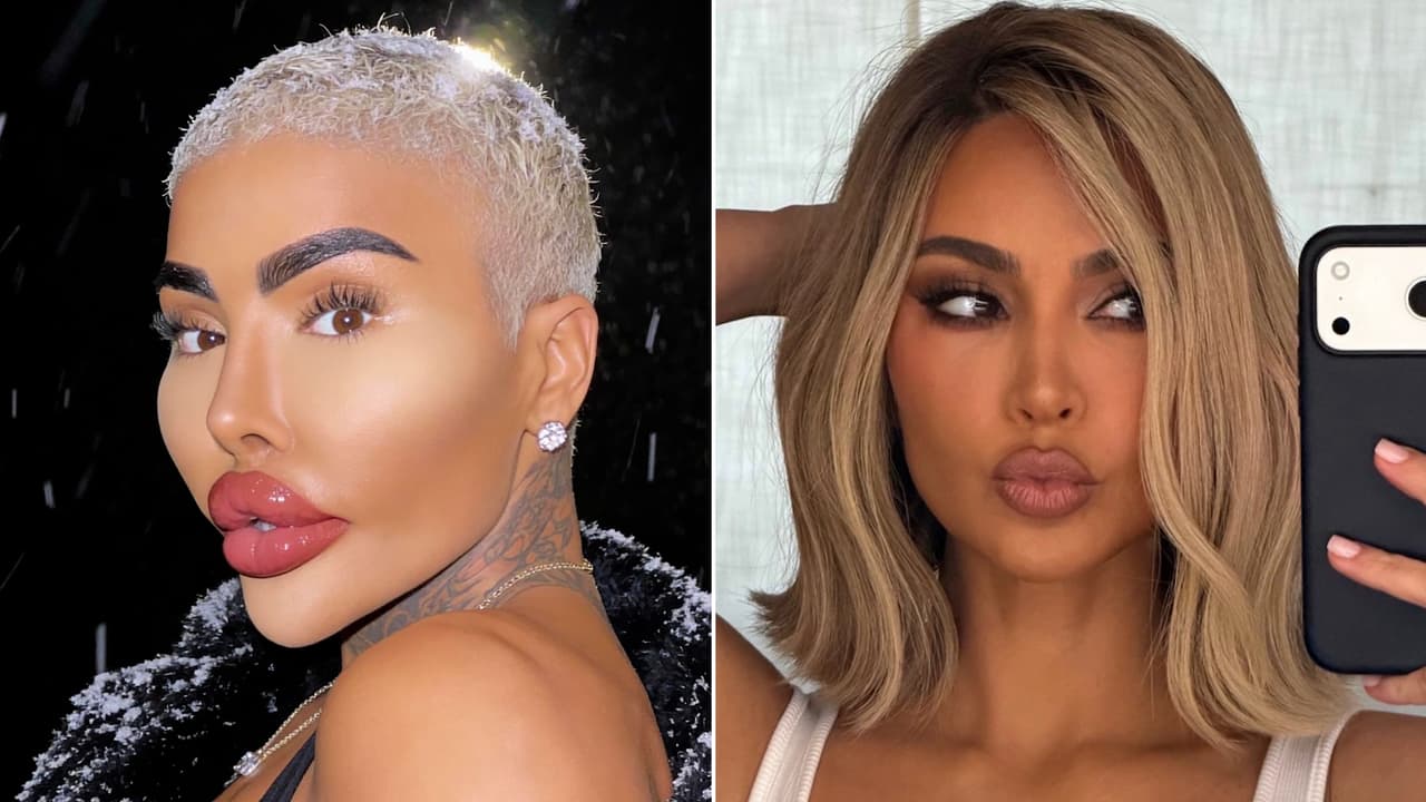 Muere ‘Lip King’ tras presunta cirugía: el ‘influencer’ quería verse como Kim Kardashian