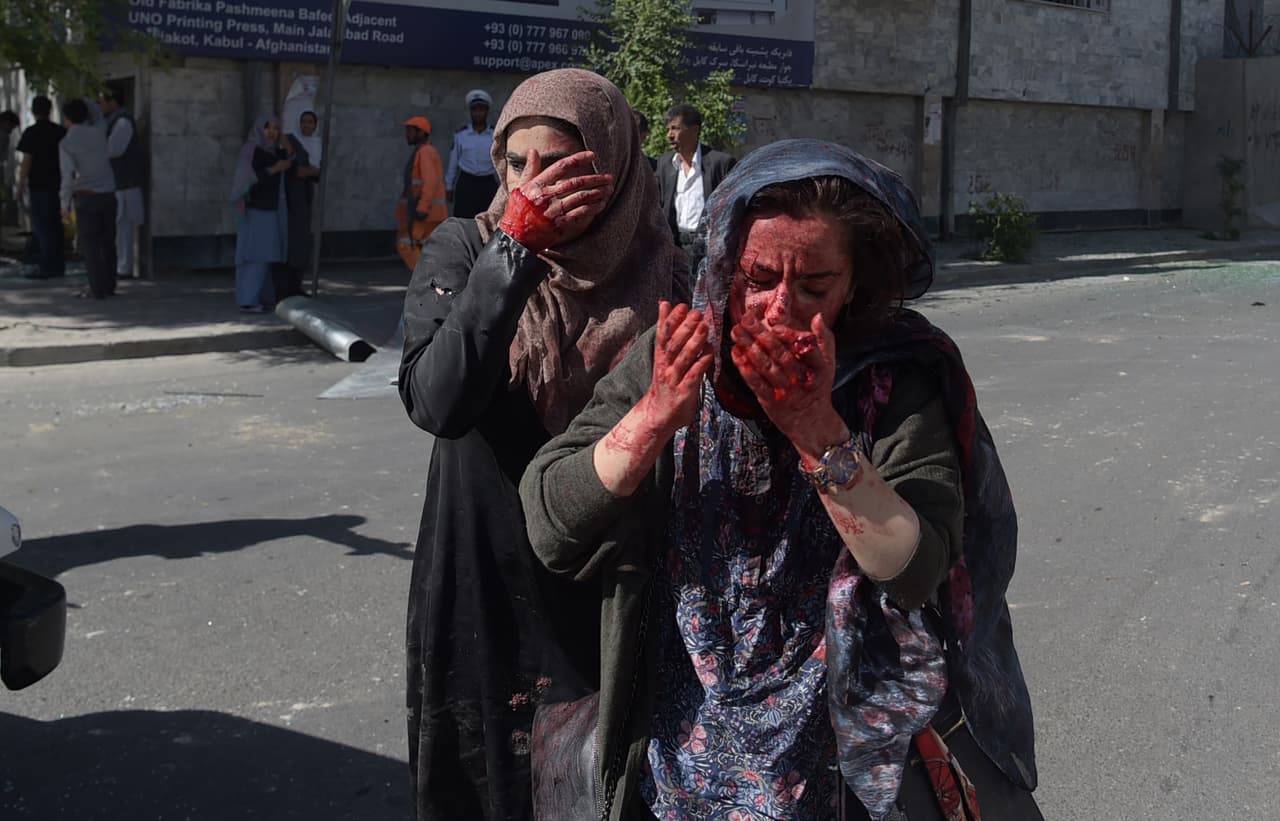 Dos mujeres heridas por la explosión de un auto-bomba en Kabul, en mayo de 2017. “Marai a menudo hablaba con sinceridad de las noches sin dormir impresionado por lo que había visto y soportado, y de sus temores mientras Kabul se deslizaba aún más en la violencia” asegura el comunicado de la AFP.