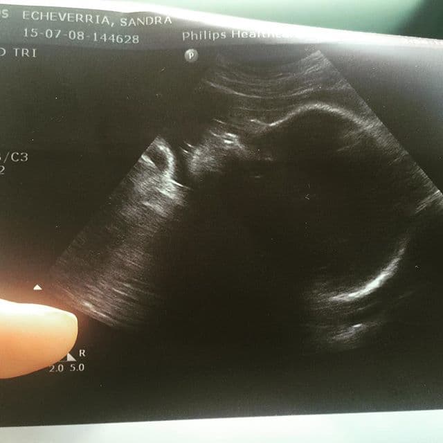 Incluso nos dejó conocer a su bebé antes de tiempo.