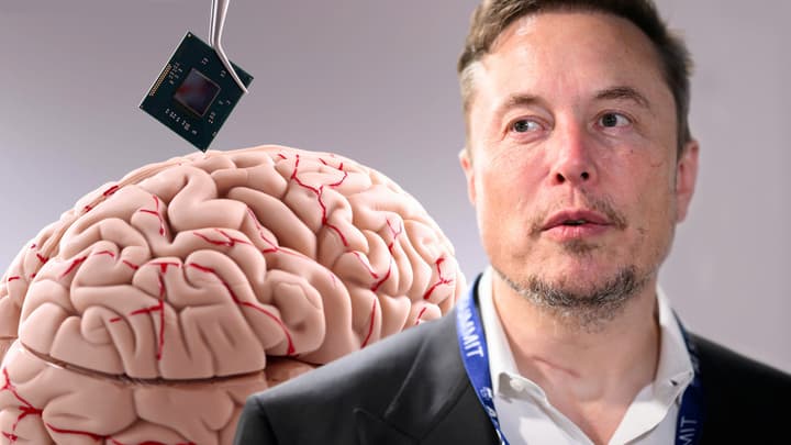 Chip cerebral de Elon Musk
