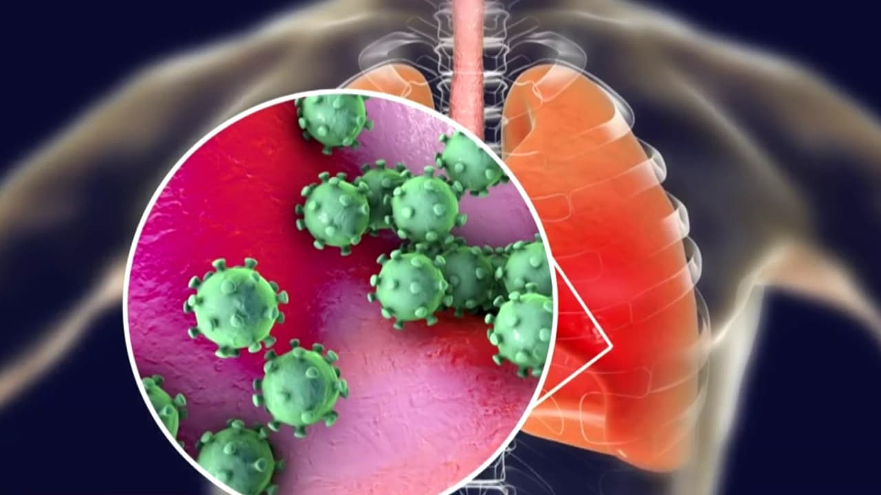 Aumento de enfermedades respiratorias en China: Dr. Juan explica si debemos o no preocuparnos